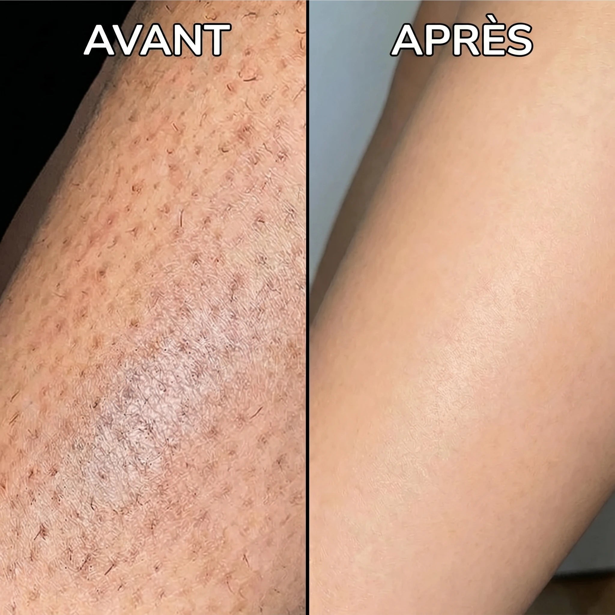 Sérum Anti-Repousse Poils