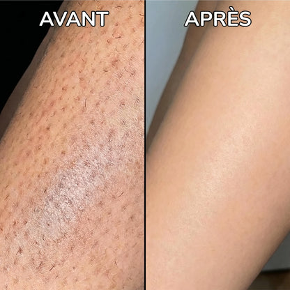 Sérum Anti-Repousse Poils