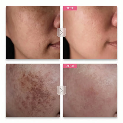 Arbutin 7% Brightening Cream
