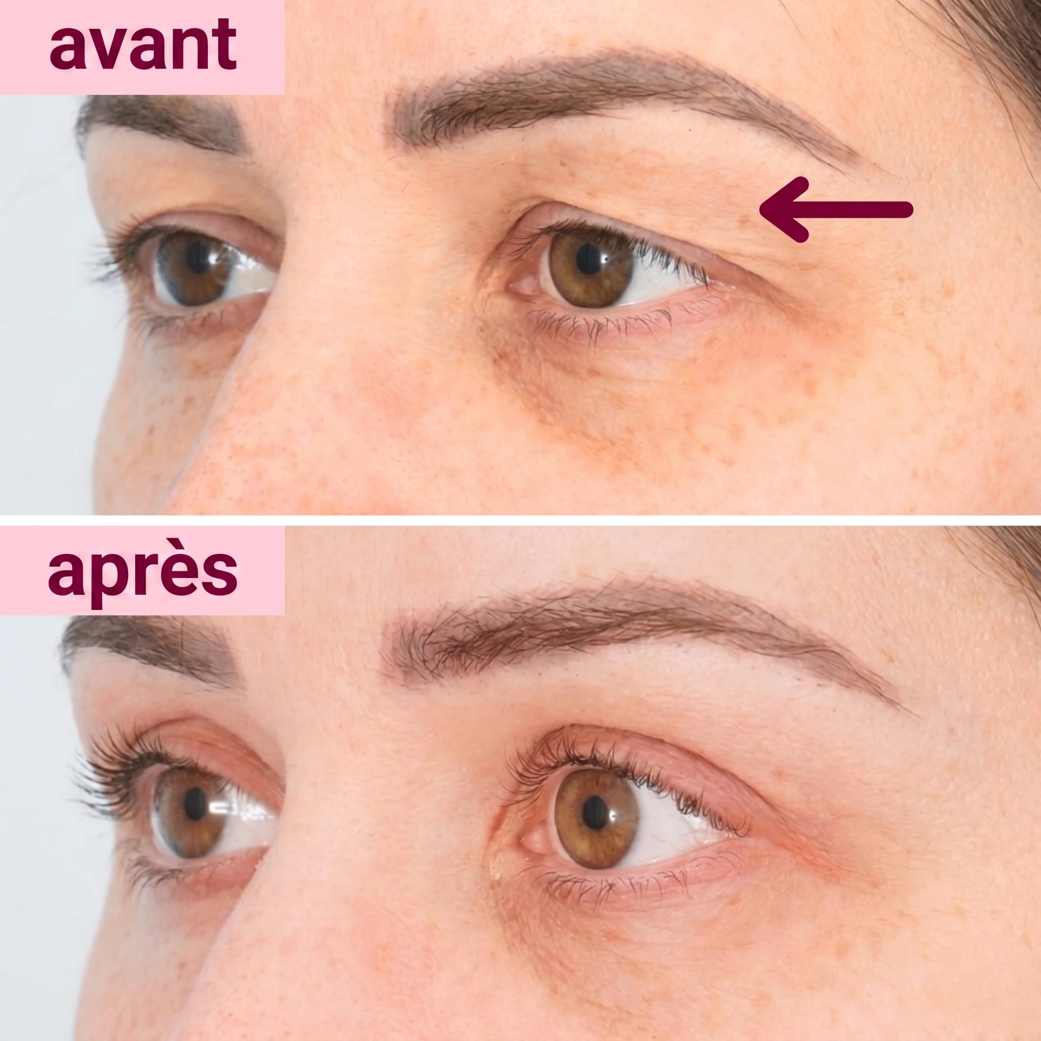 PATCH EFFET LIFTING