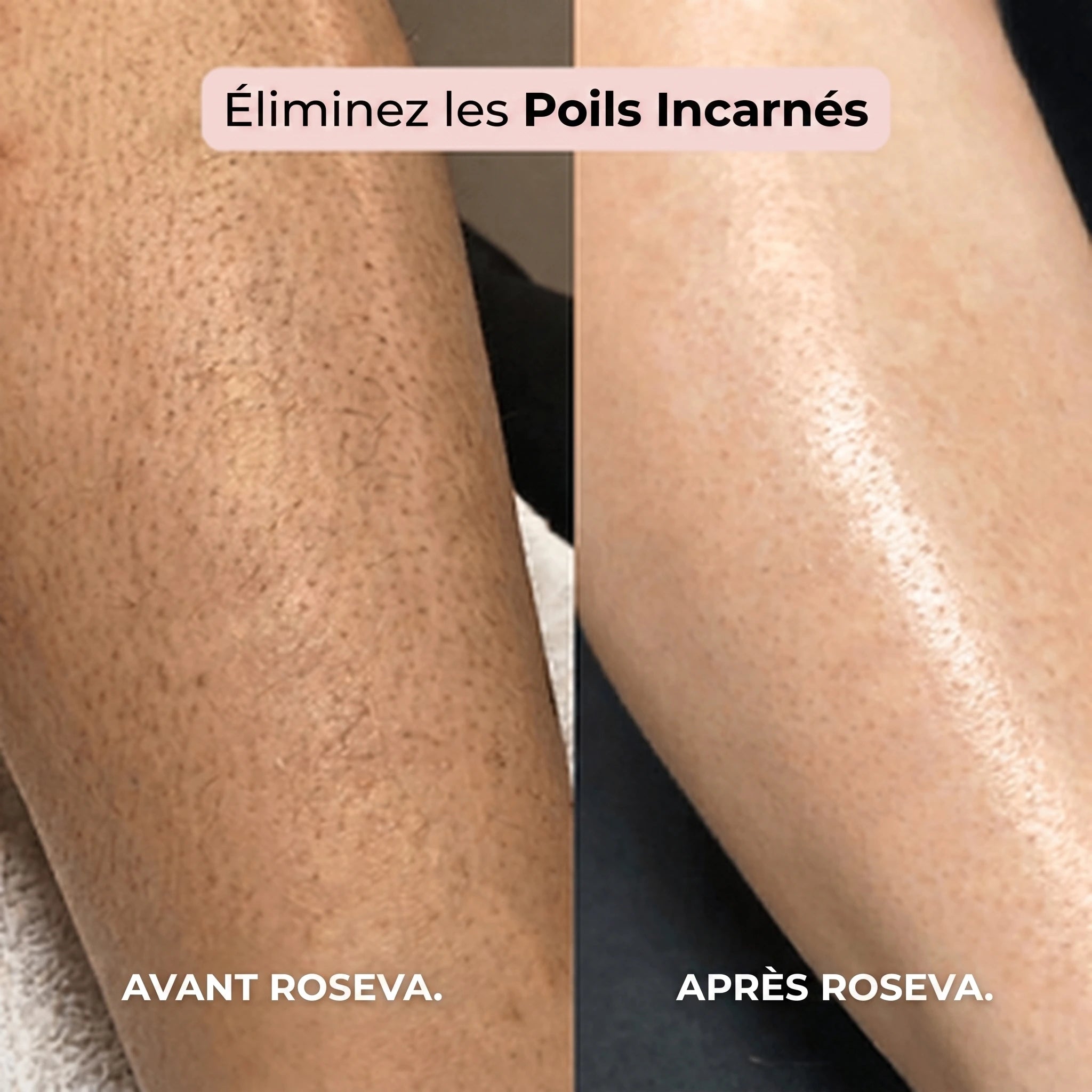 RASOIR 2 EN 1 BIKINI ET CORPS ROSEVA™