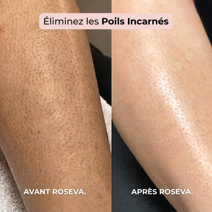 RASOIR 2 EN 1 BIKINI ET CORPS ROSEVA™