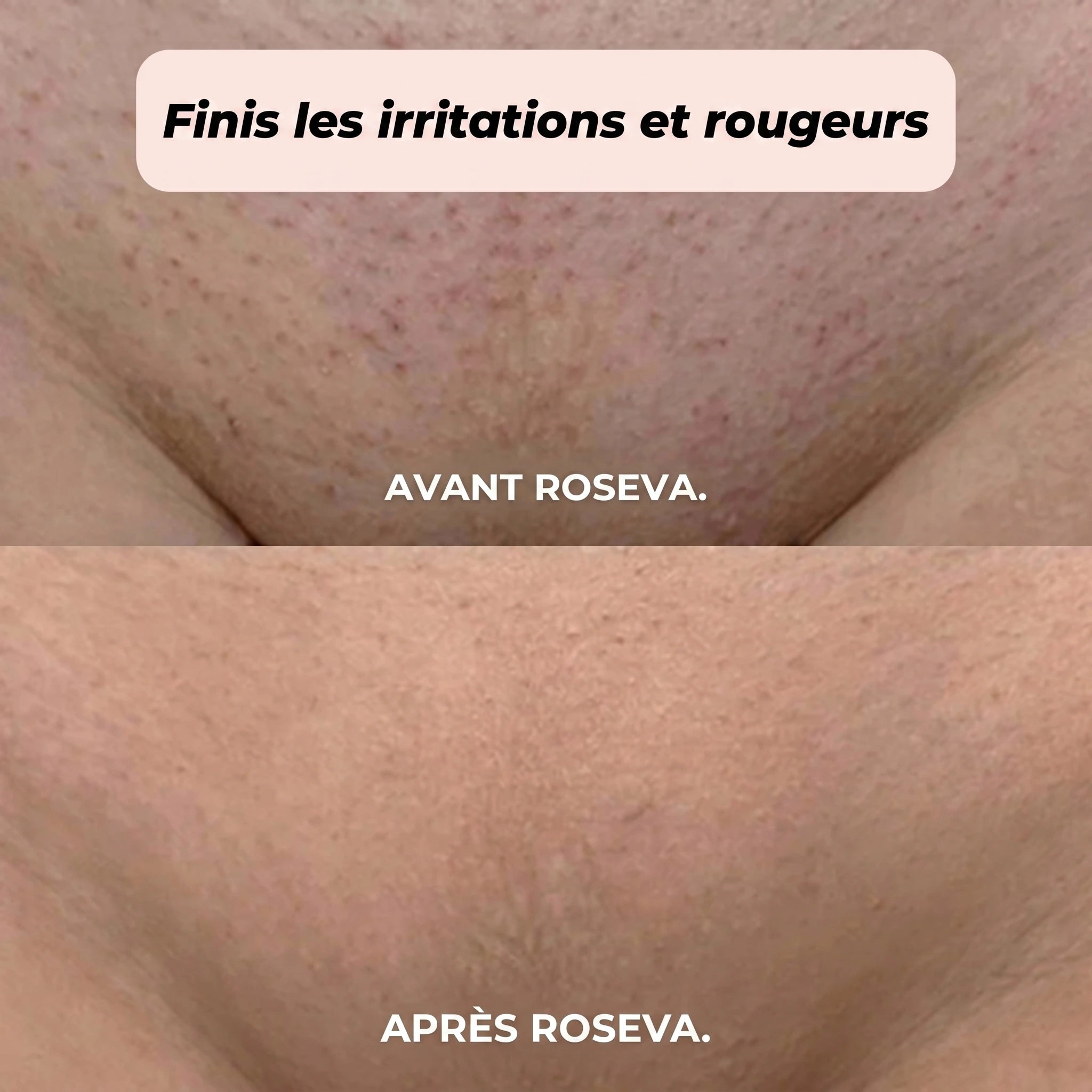 RASOIR 2 EN 1 BIKINI ET CORPS ROSEVA™