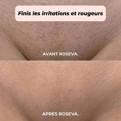 RASOIR 2 EN 1 BIKINI ET CORPS ROSEVA™