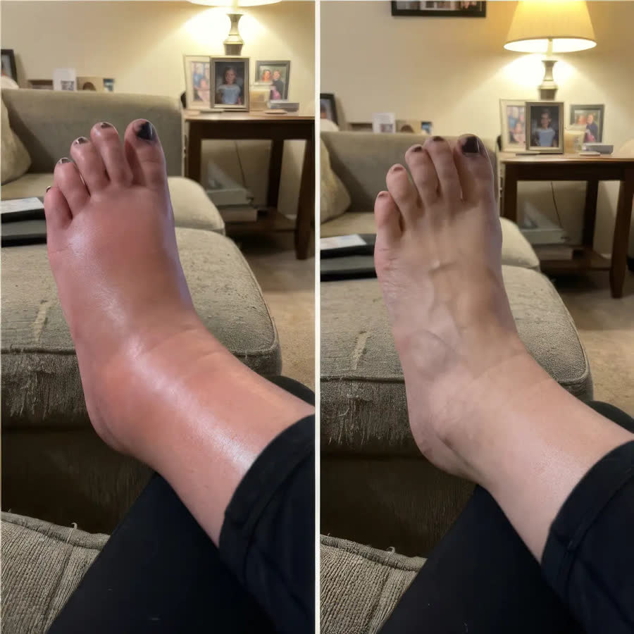 Light legs and normal ankles at the end of the day with Roseva